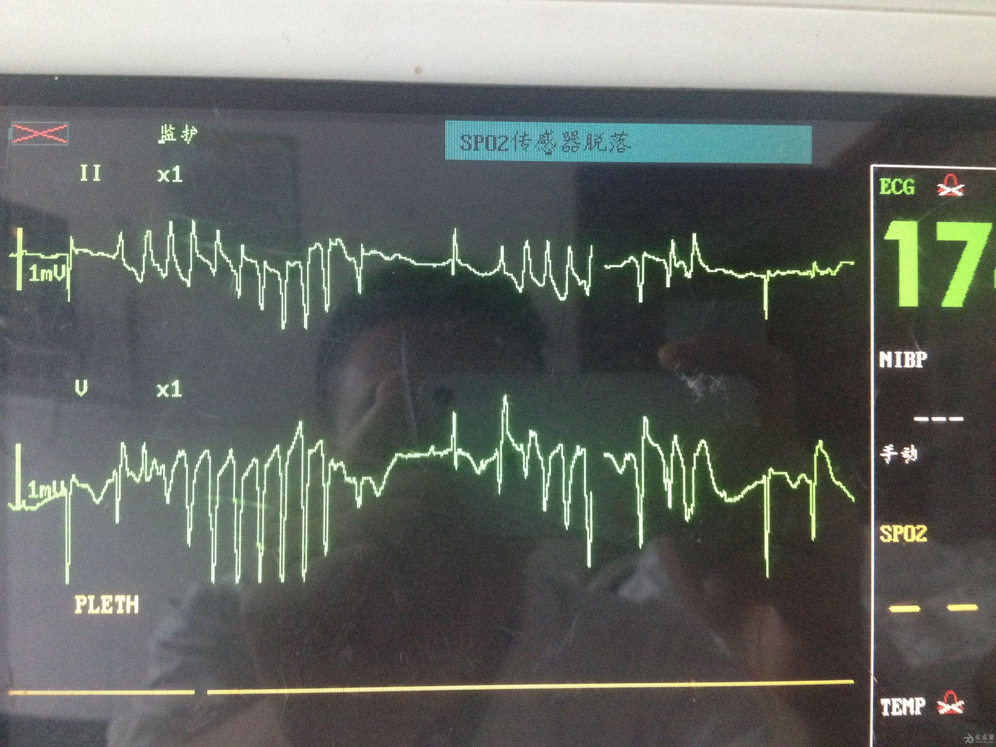 理邦仪器获得发明专利授权:“一种脑电阻抗测量系统及脑电阻抗的测量方法”