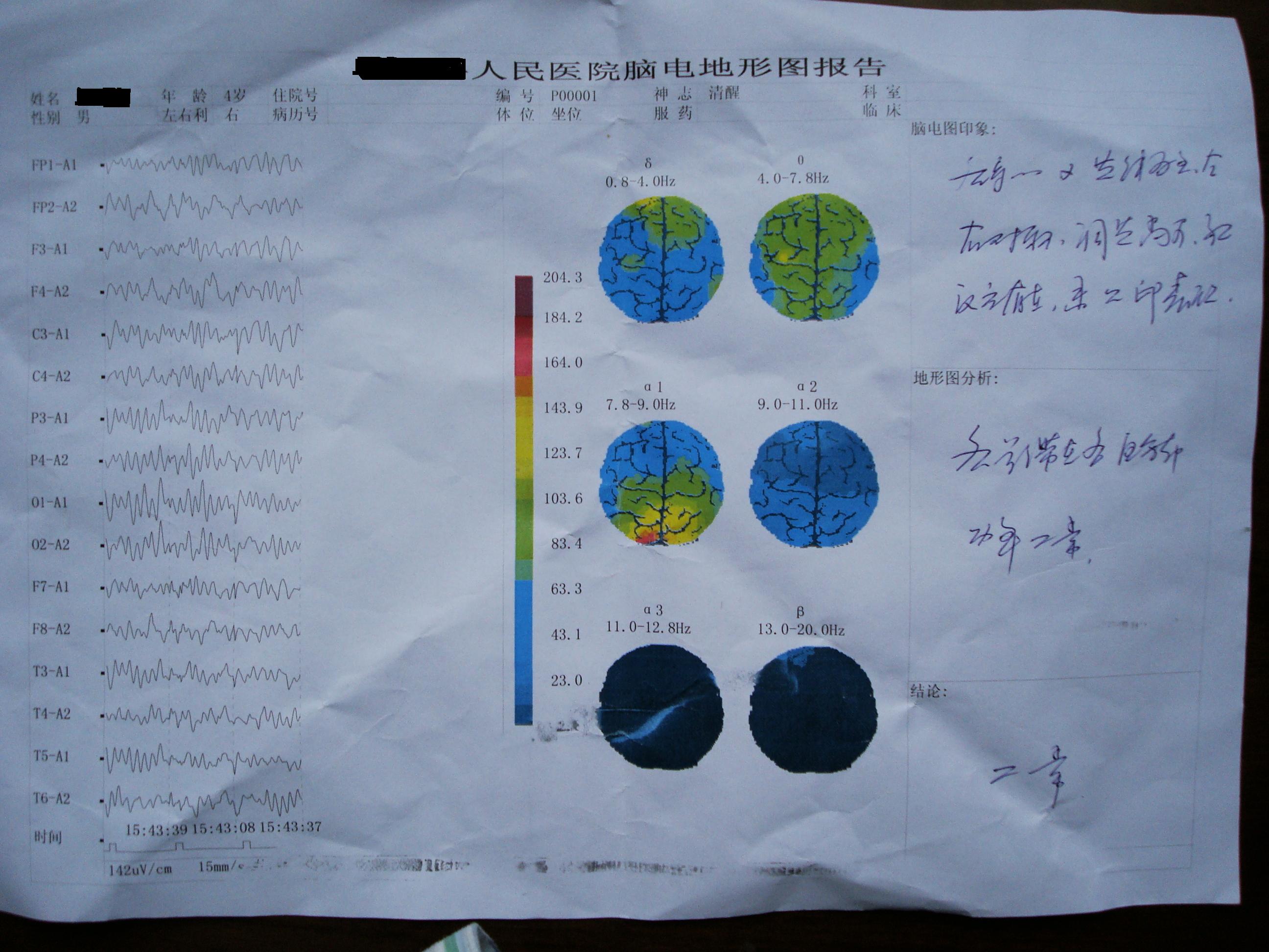 理邦仪器获得发明专利授权:“一种脑电阻抗测量系统及脑电阻抗的测量方法”